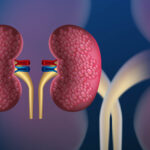 kidney doctor in Delhi explained the habits that cause kidney disease