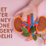 diet after Kidney stone Surgery in delhi