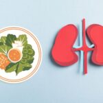 kidney stone surgery diet in delhi