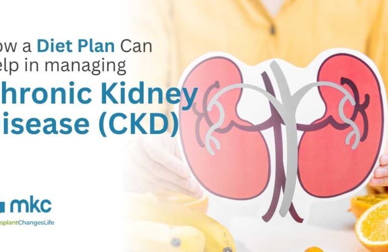 Diet Plan Can Help in managing Chronic Kidney Disease (CKD)