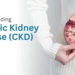 Understanding Chronic Kidney Disease (CKD)