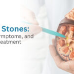 Kidney Stones: Causes, Symptoms, and Modern Treatment Options