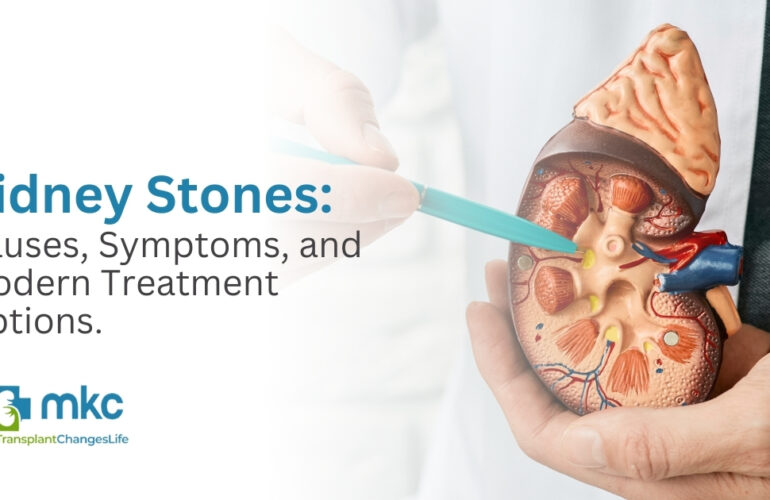 Kidney Stones: Causes, Symptoms, and Modern Treatment Options