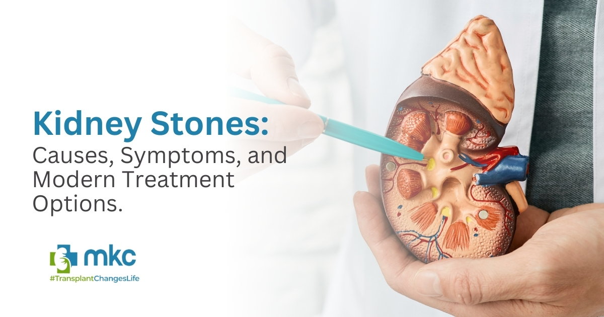 Kidney Stones: Causes, Symptoms, and Modern Treatment Options